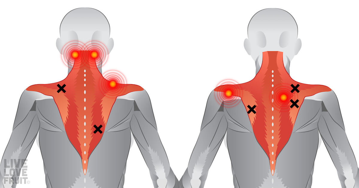 Back, Neck, Shoulder Problem